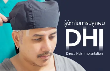 การปลูกผมด้วยการใช้อุปกรณ์ {DHI}