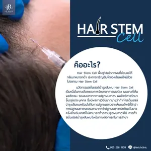 การปลูกผมด้วยเทคนิค {Hair Stem Cell}