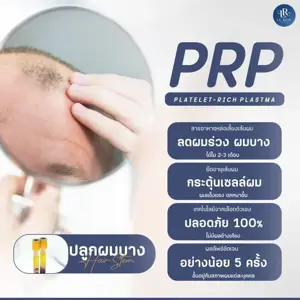 การปลูกผมด้วยเทคนิค {PRP}